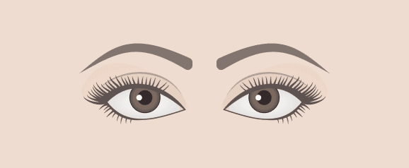 Close Set Eyes