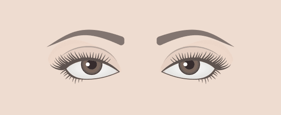 Downturned Eyes