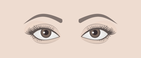 Protruding Eyes