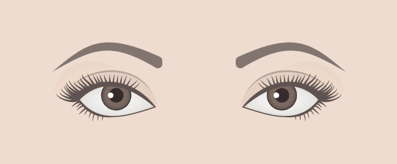 Wide Set Eyes