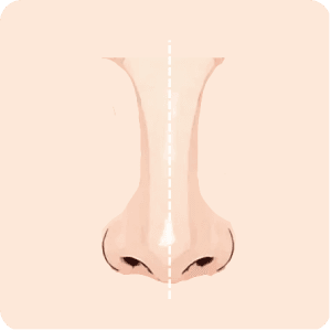 Nose symmetry