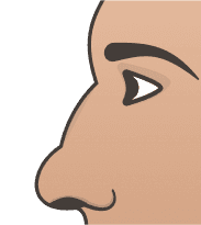 Bulbous Nose illustration