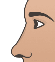 Button Nose illustration