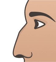 Crooked Nose illustration