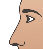 Roman (Aquiline) Nose illustration